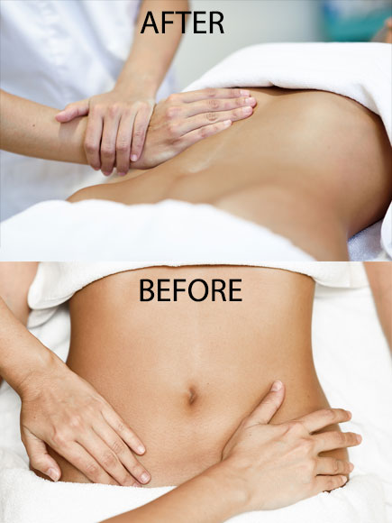 Treatment Hands Massaging Female Abdomen before after